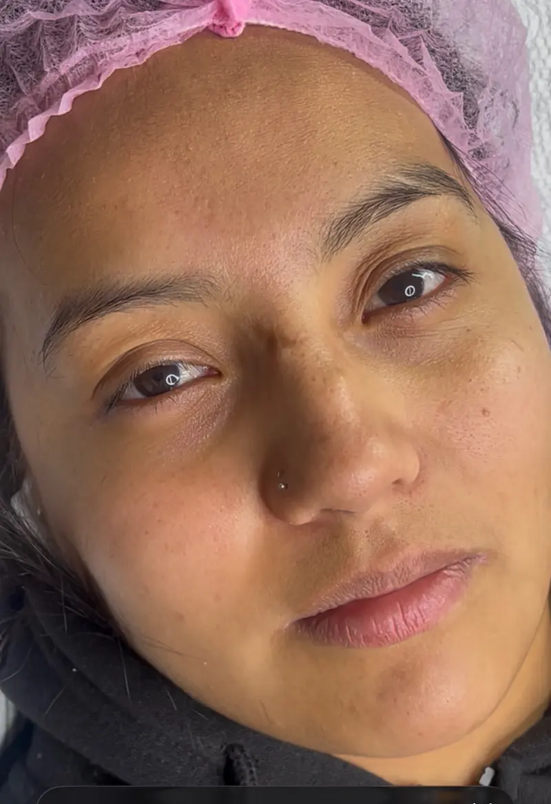 Before permanent eyeliner