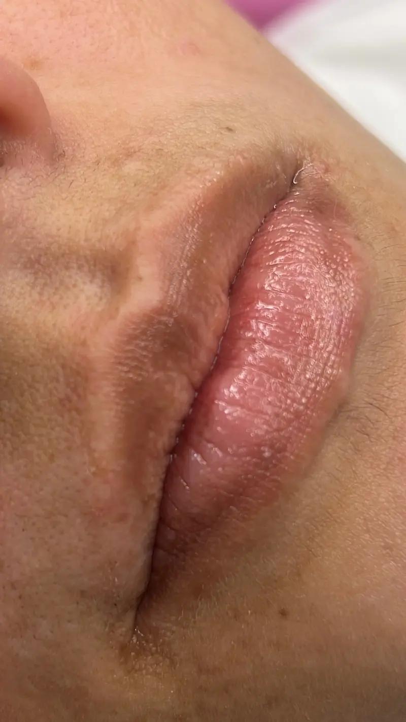 Before lip blushing